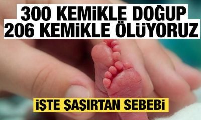 VÜCUDUMUZDAKİ DEĞİŞİM! DOĞDUKTAN SONRA KAYBOLAN 94 KEMİĞE NE OLUYOR?